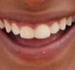Sag Cheeeeeeeeese