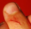 Ubuntu mit Usability-Umfrage und One Hundred Paper Cuts Projekt