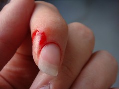 Ubuntu mit Usability-Umfrage und One Hundred Paper Cuts Projekt Finger Cut