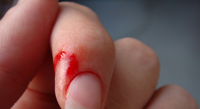 Finger Cut